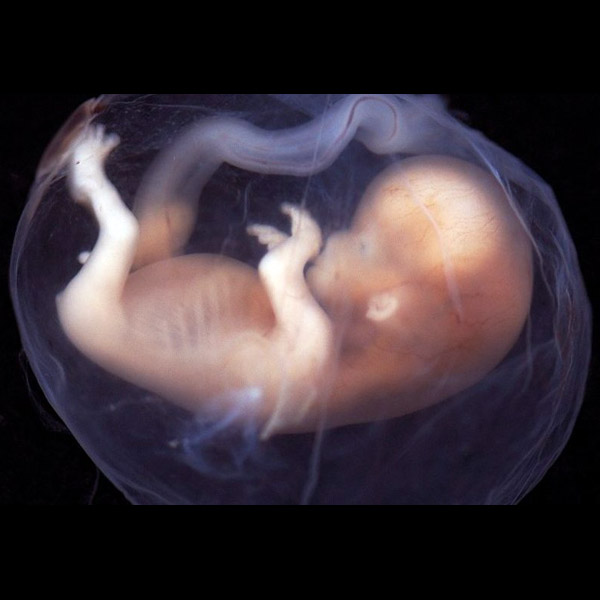 187-06-embryo